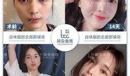 杭州整容爆料事件视频曝光,揭秘美容行业潜规则与真实案例